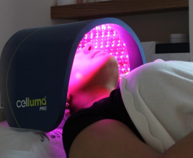 LED light therapy panel glowing over a face during treatment, the clinic version of an LED face mask for acne