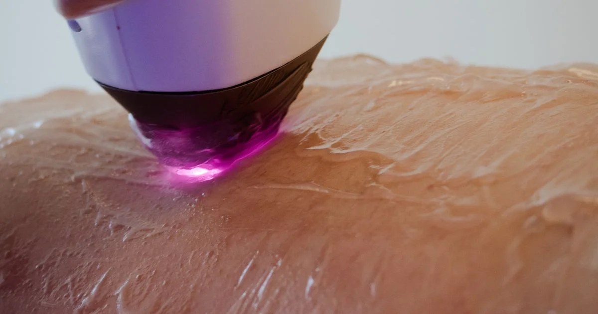 Handheld IPL hair removal device flashing a pulse of light onto skin at home
