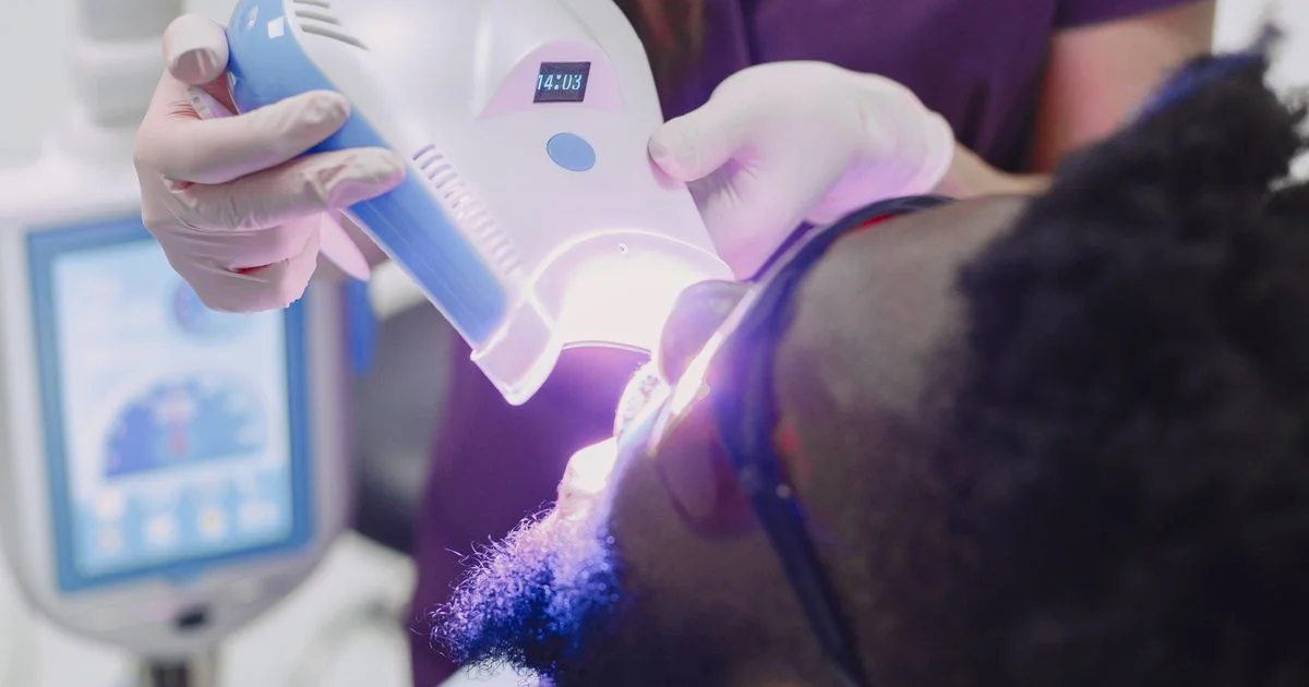 Blue LED whitening lamp applied to teeth, the light side of whitening strips vs LED teeth whitening kit
